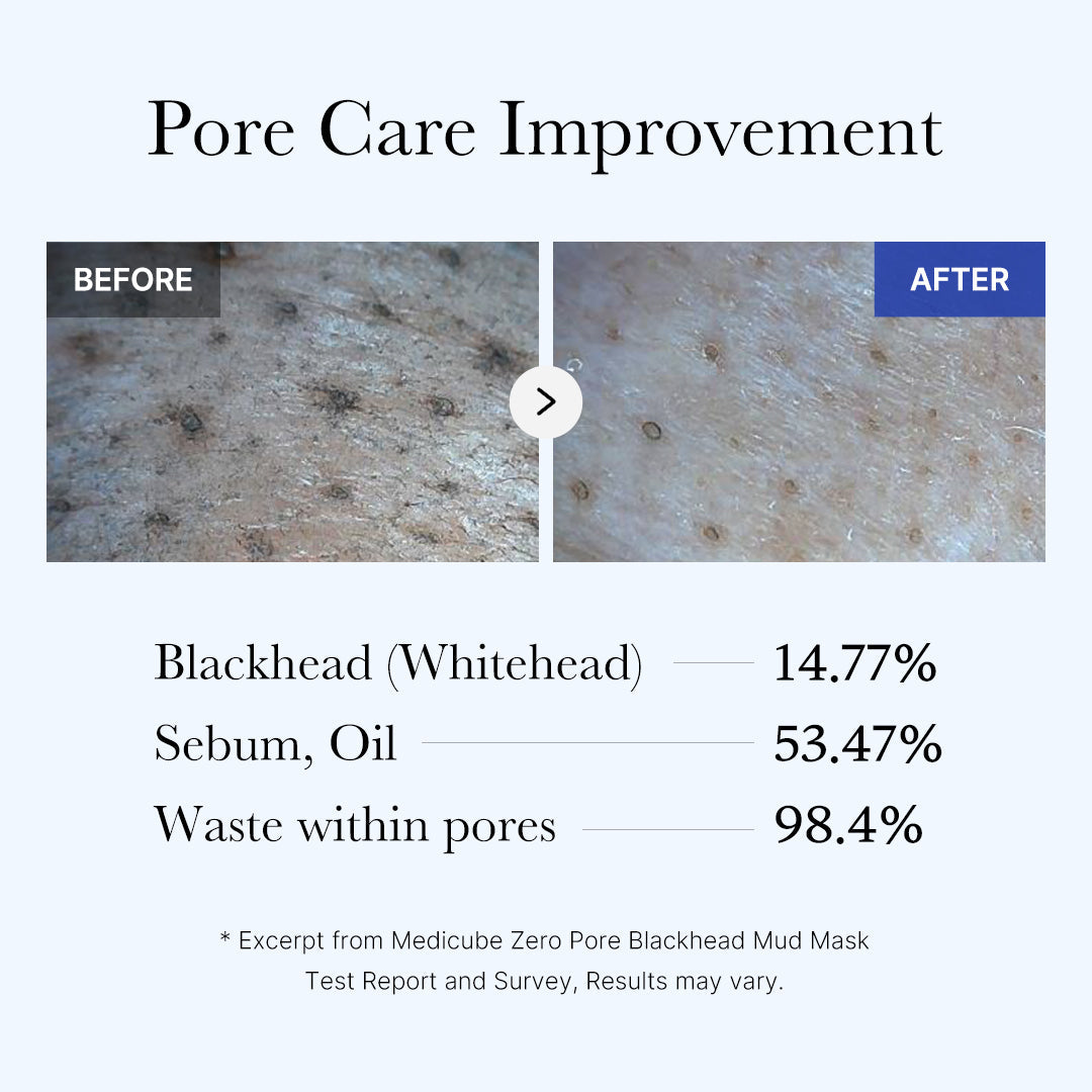 [Subscr.] Zero Pore Blackhead Mud Mask