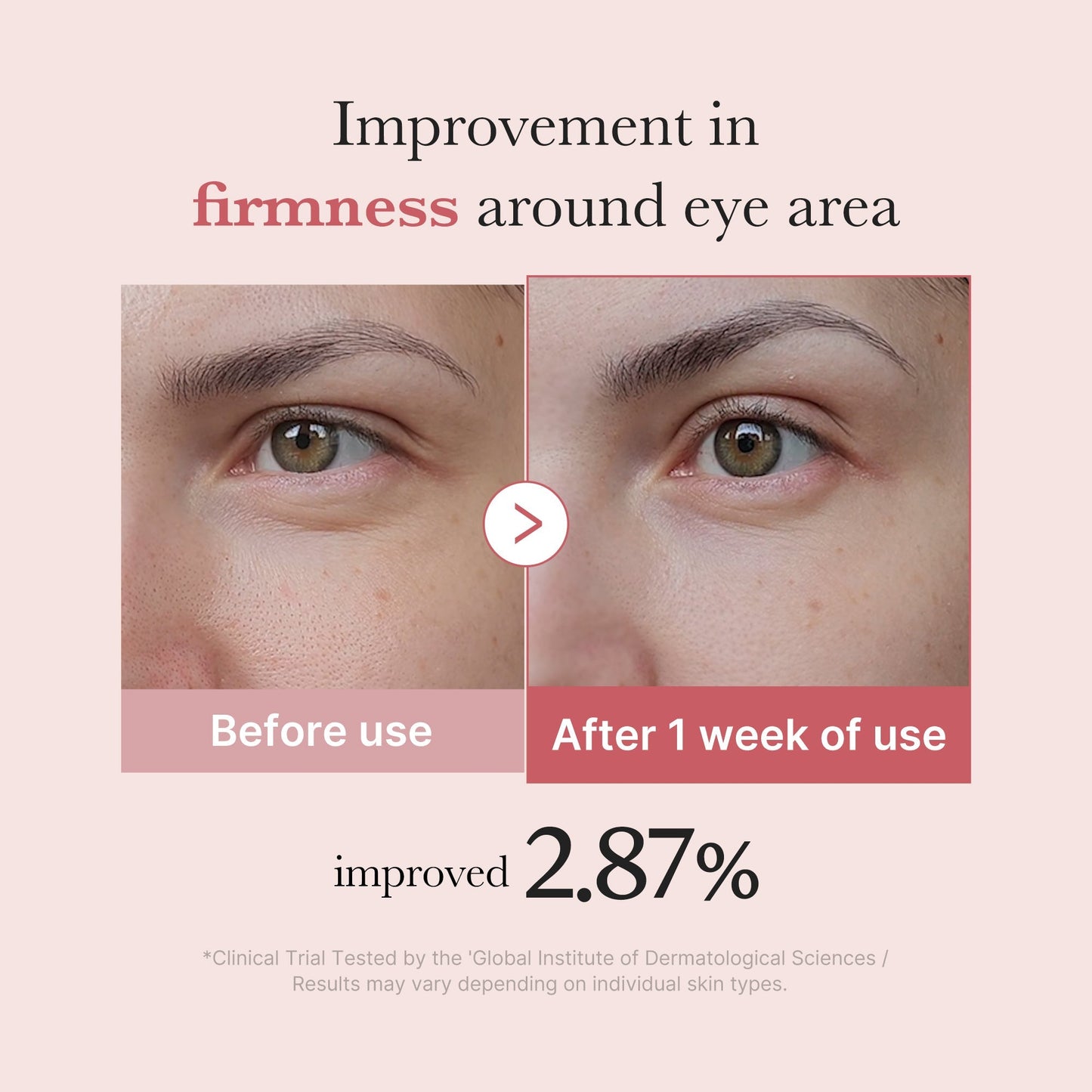 PDRN Pink Peptide Eye Cream